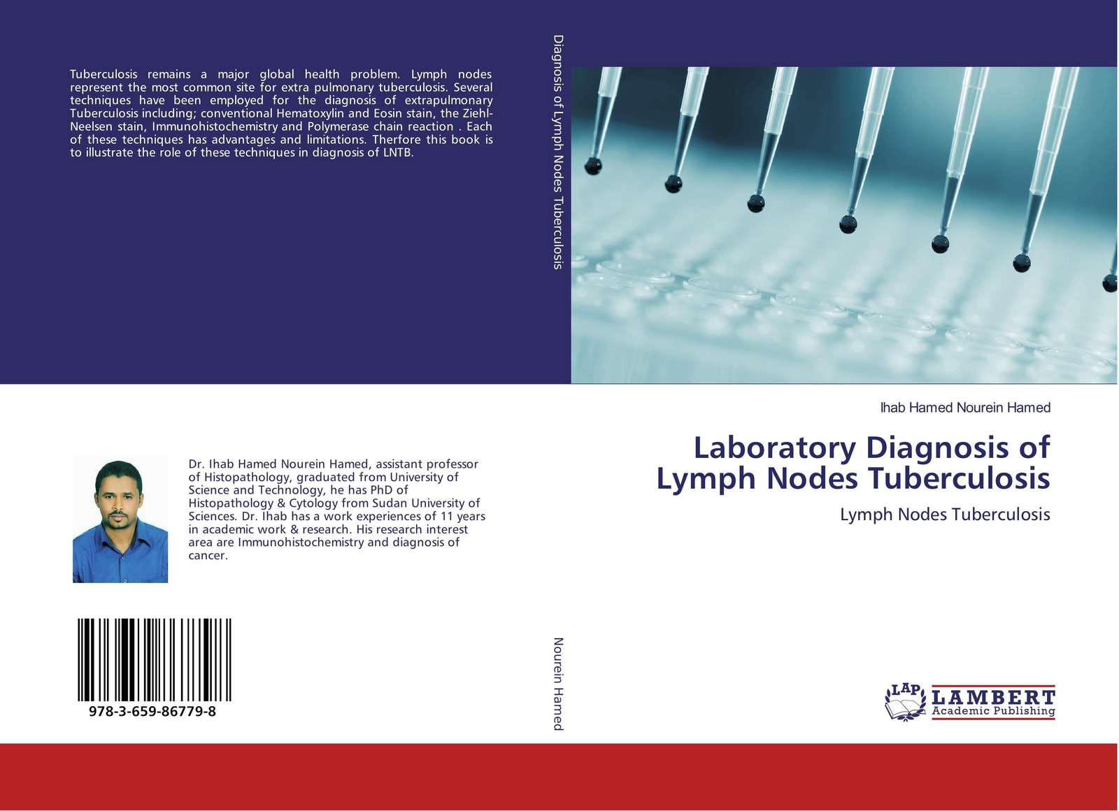 Thumbnail - Ihab Hamed Nourein Hamed | Laboratory Diagnosis Of Lymph Nodes