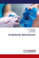 Shashank Agarwal (U. A.) | Endodontic Retreatment | Taschenbuch | Englisch
