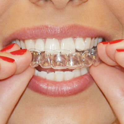 Protège-dents silicone pour dents serrant broyage de l'aide au sommeil  dentaire