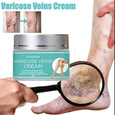 Varicose Veins Miracle Cream for Swollen Legs / Instant Refreshment Balm 50g