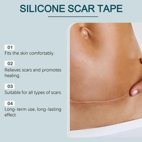 1* Silicone Scar Sheets,Silicone Scar Tape,Silicone Sheets for Scars Hot Sale - Bild 11 von 19