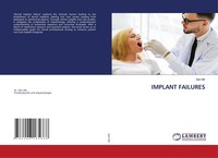 Implant Failures Zain Mir
