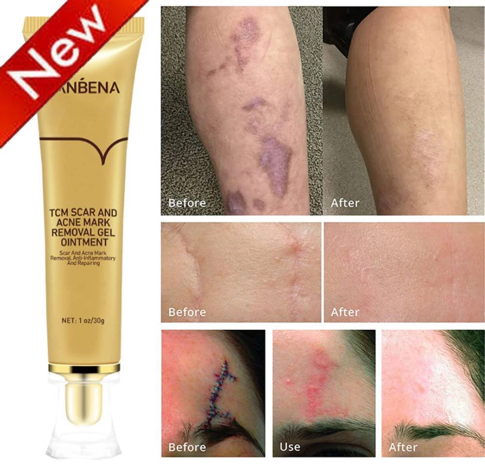Cream clearance for marks
