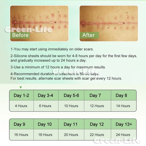 Silicone Scar Sheets & Tape Roll 1.5/3/5M | Scar Removal, Keloid, Acne, Marks - Picture 17 of 20