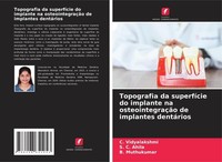 Topografia Da SuperfíCie Do Implante Na OsteointegraçãO De Implantes DentáRios C
