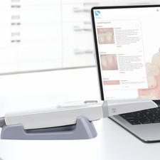 Dental Intra-oral Scanner 3D Display AI Scanning Software / Intraoral Scan Tips
