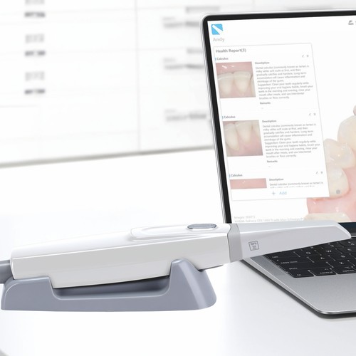 Dental Intra-Oral 3D Scanner CAD/CAM Scanning Machine with Software ...