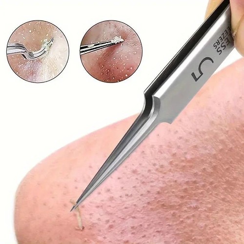 1 Pack No.5 Fine Acne Tweezers Blackhead Remover Needle Tool for Skin Care - Picture 16 of 24
