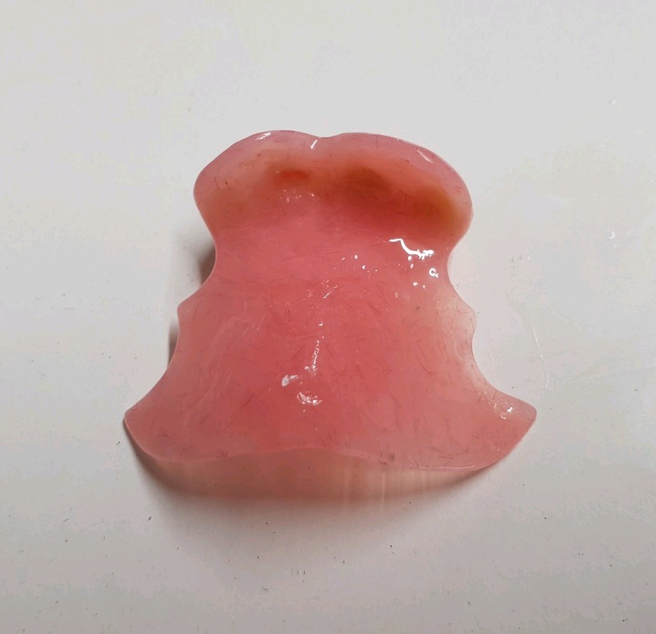 Produktbild von Teil-Zahnprothese Oberkiefer – Gebissersatz, Zahnersatz, Prothese (unbranded)