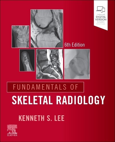 Fundamentals of Skeletal Radiology by Kenneth S. Lee - 9780443264542