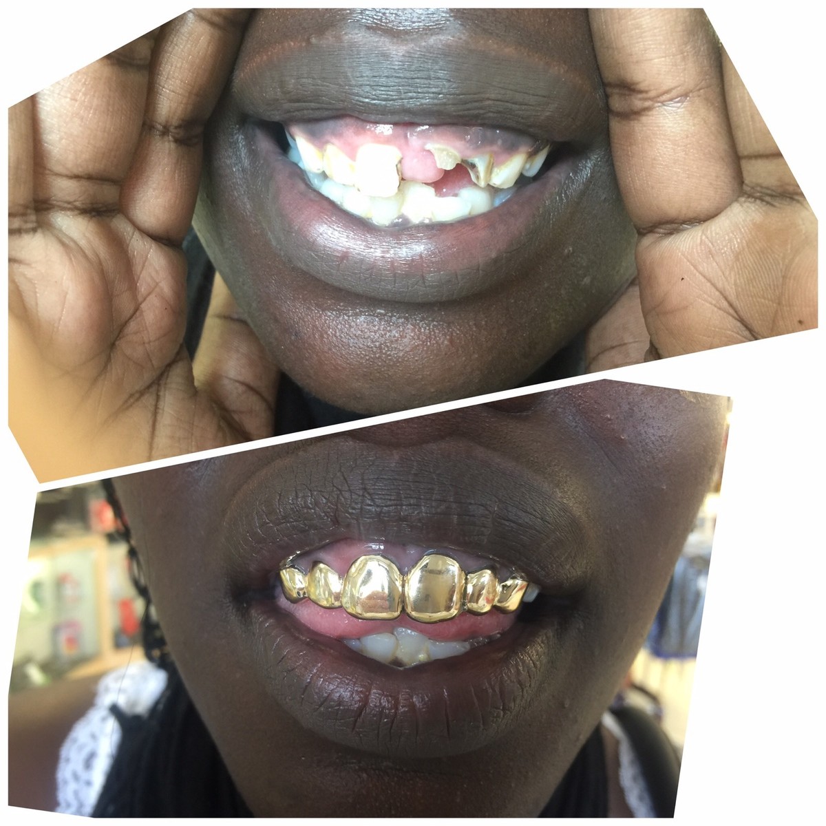 14k Solid Gold Grills With Deep Cut/Permanent Looking 6  6 Permanent Look Custom Gold Grillz aka Gold Teeth main image 0