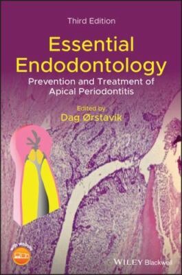 Essential Endodontology: Prevention and Treatment of Apical Periodontitis, , Ver