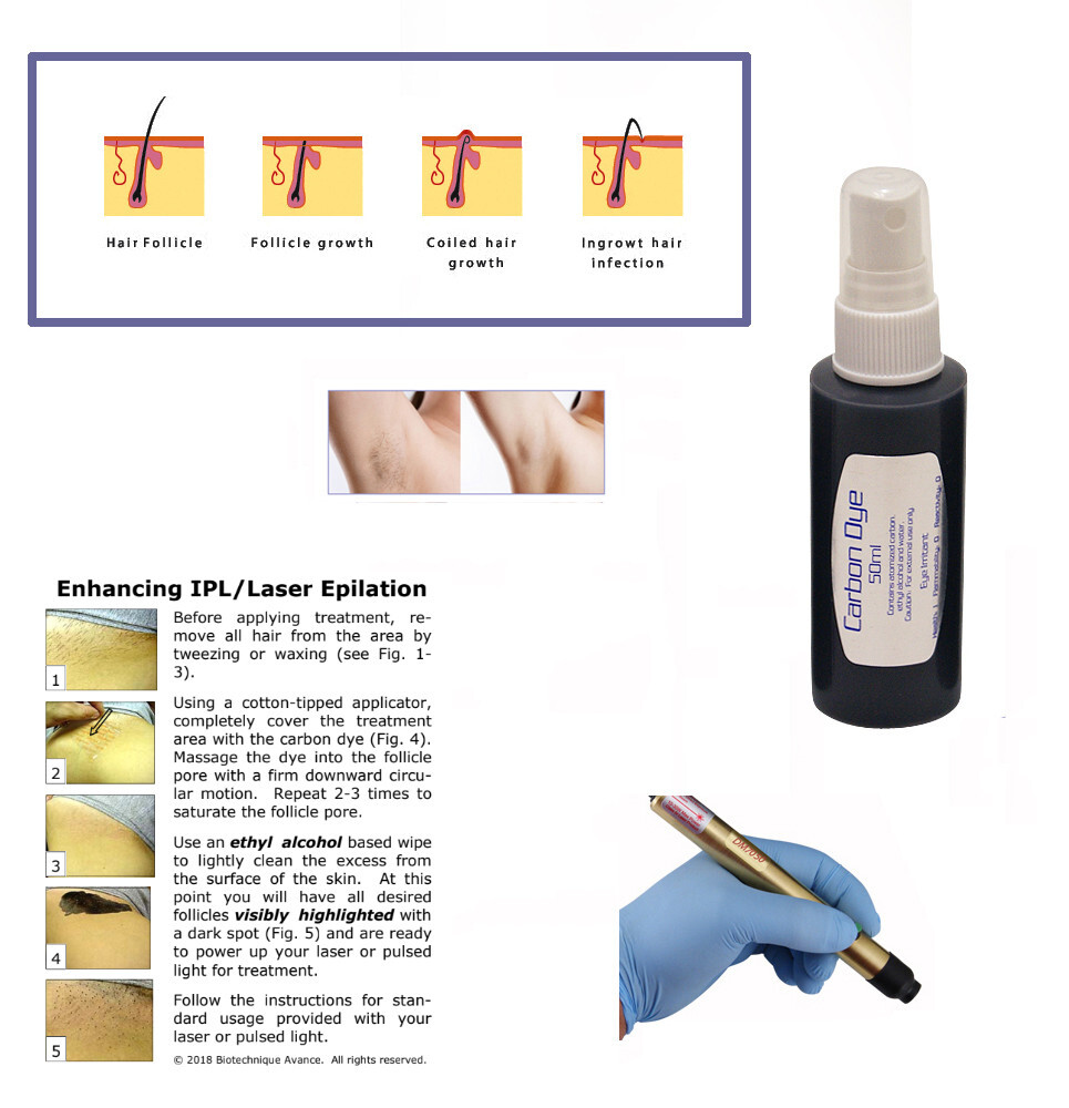 CDLV50 permanent hair reduction, photo-facial, Hollywood peel skin resurfacing.