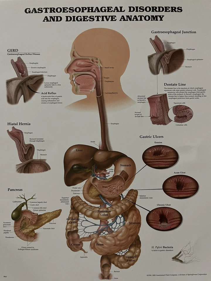 Anatomical Chart ~ Gastroesophageal Disorders & Digestive Anatomy ~ 11.25 x 14