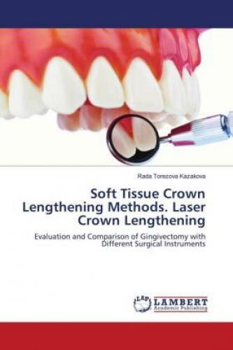 Thumbnail - Soft Tissue Crown Lengthening Methods. Laser Crown Lengthening