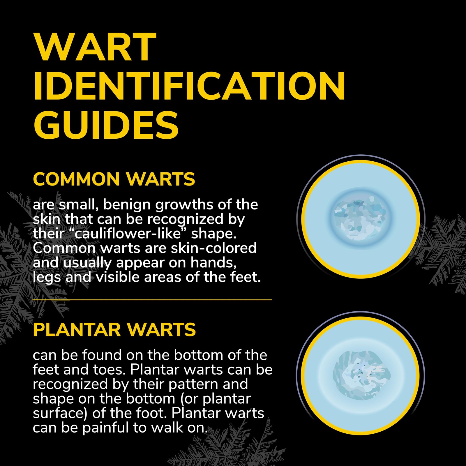 Dr. Scholls Freeze Away MAX Wart Remover, 10 Treatments - As Fast As 10 Seco...