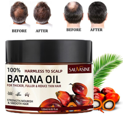 Batana Oil & Rosemary Serum for Hair Growth Shampoo Anti Hair Loss Conditioner