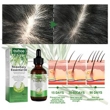 Huile de Romarin Pour Cheveux, Rosemary Oil for Hair Growth & Skin Care remedies
