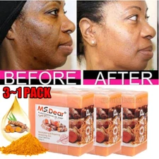 3/2X Tumeric Soap Skin Whitening Dark Spots lightening Acne Brightening Turmeric