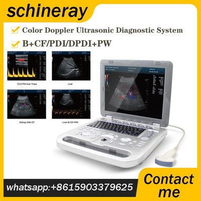 Portable Color Doppler Ultrasound Scanner Convex Probe USG Diagnostic Systems