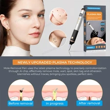 Anti-Aging Laser Plasma Pen Mole Removal Dark Spot Skin Tag Tattoo Wart Remover