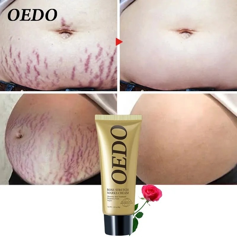 Crème vergeture grossesse bio soin raffermissant anti-marques 200ml