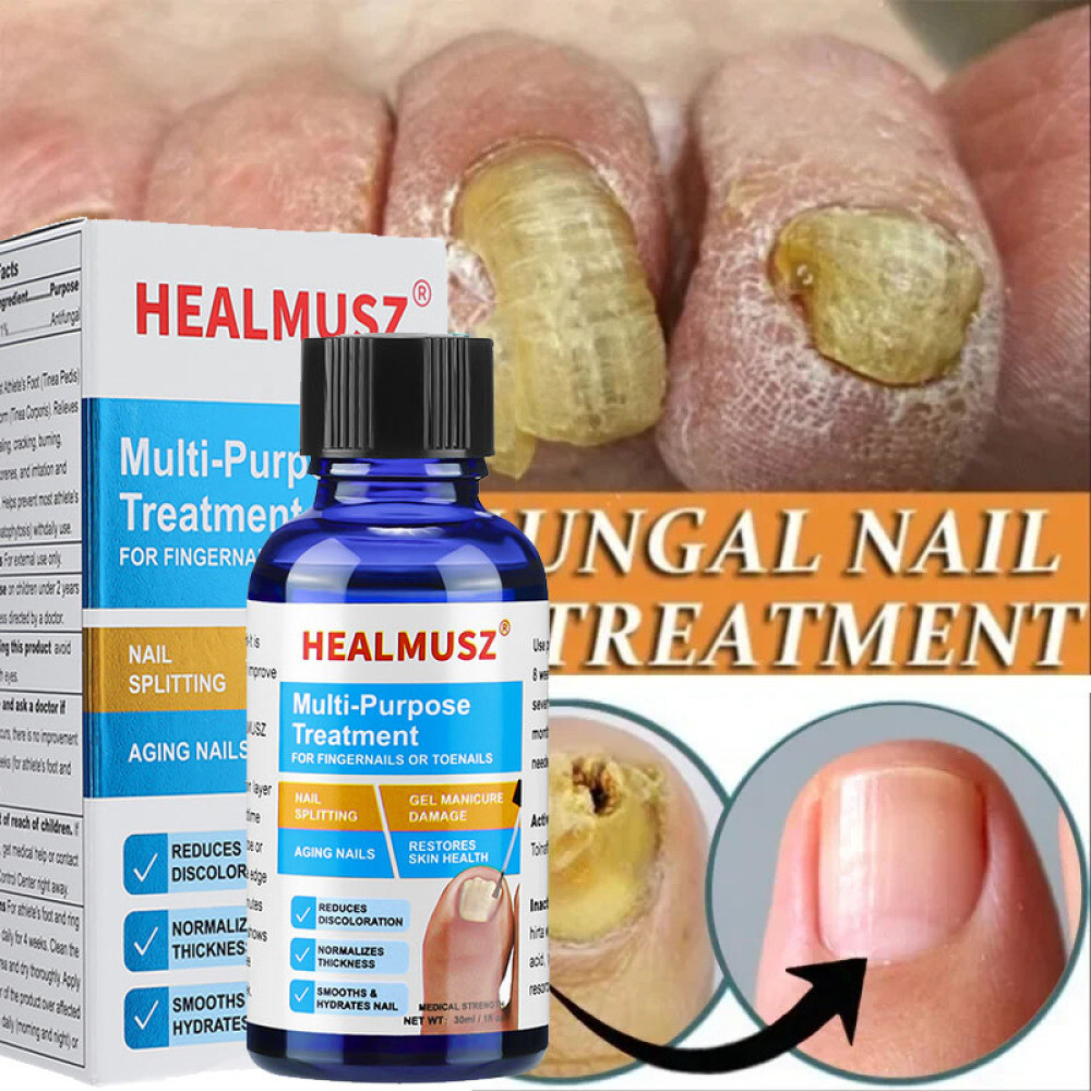 Extra Strength Toenail Fingernail Fungus Treatment Nail