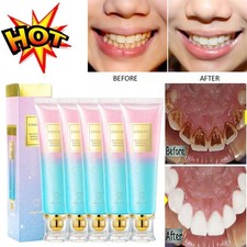 1-5X Niacinamide Whitening Toothpaste Nicotinamide Dazzle White Toothpaste 100g