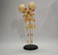 Feto Fetal Esqueleto Enseñanza Modelo Educativo Doble Cabeza Bebé Calavera Esqueleto