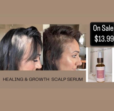 hair growth oil fast aloe vera vitamin E scalp serum hydration natural  organic | eBay