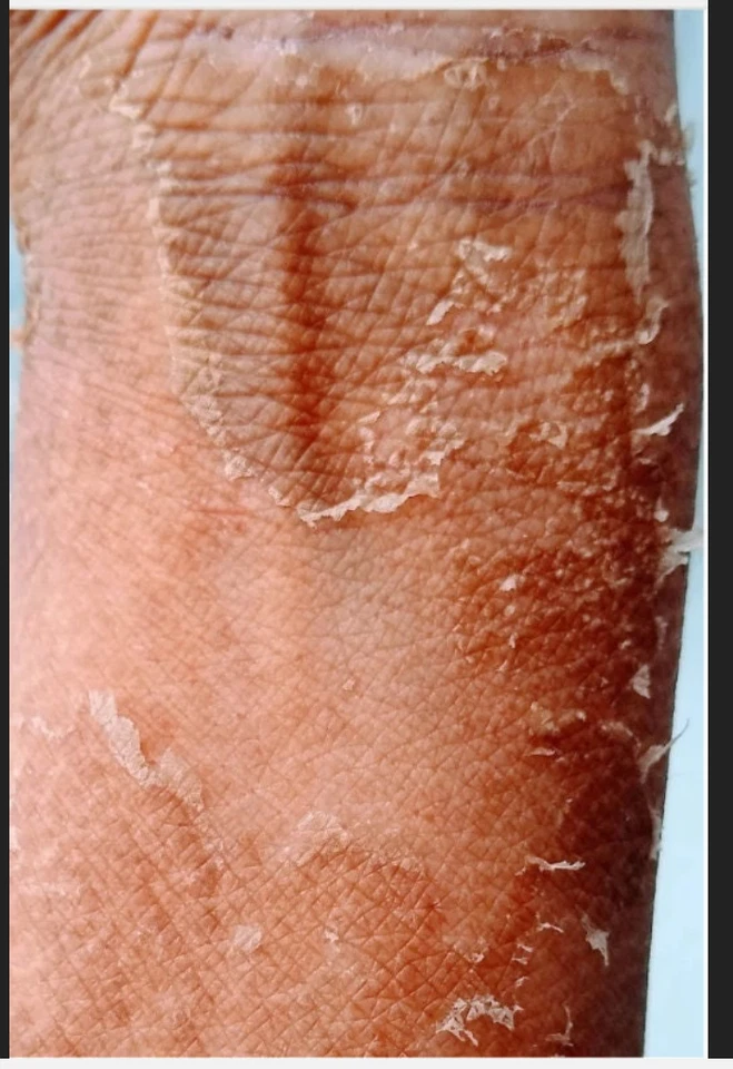 Yellow peeling oil  Extra strength - Image 3 of 4