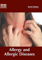 Kevin Parker | Allergy And Allergic Diseases | Buch | Englisch (2018) | Gebunden