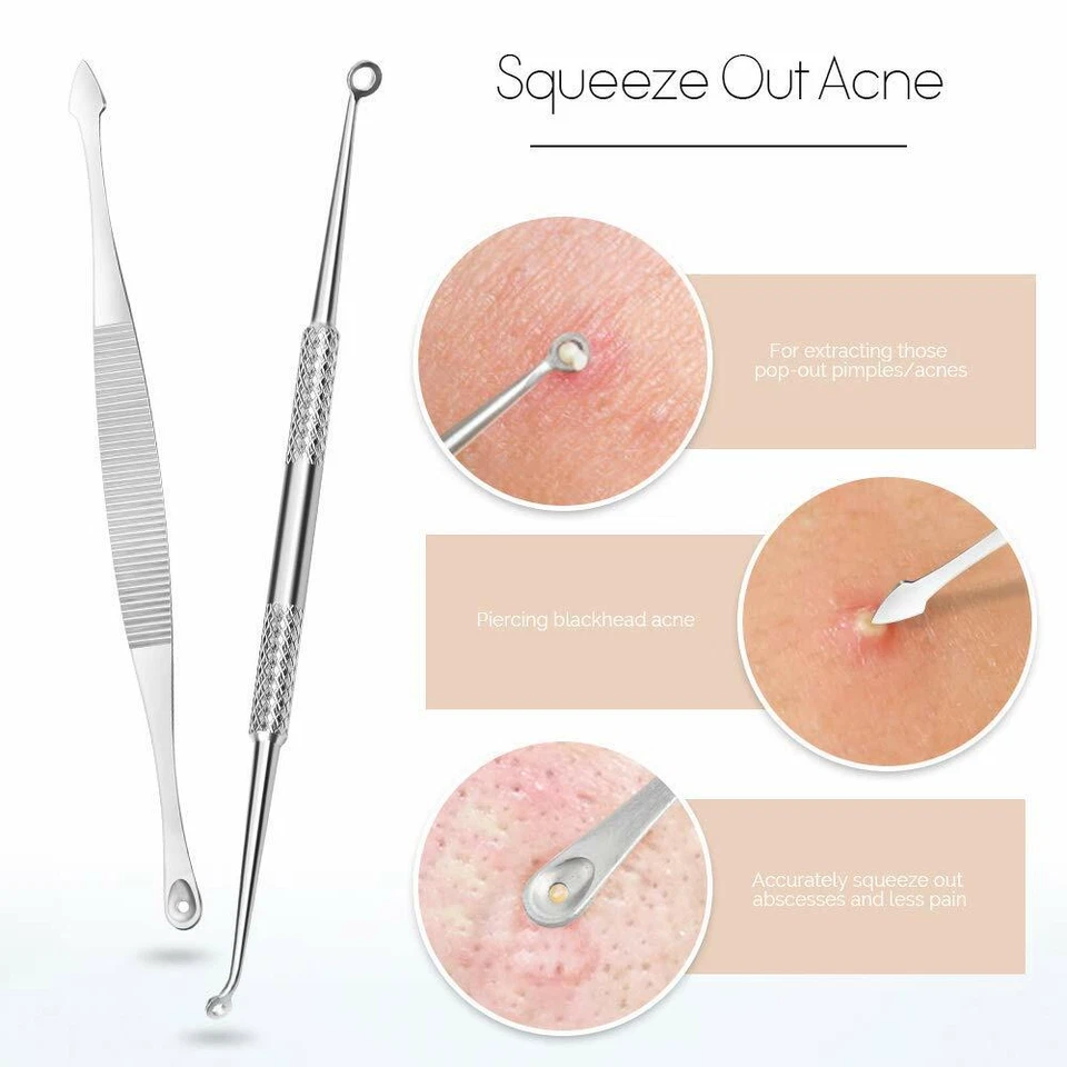 Kit de herramientas removedor de espinillas Pimple Popper comedón herramientas extractor de manchas de acné - Imagen 4 de 4
