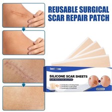Silicone Scar Removal Sheets - 4 Pcs, Medical Grade
