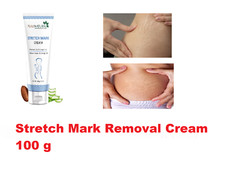 Stretch Marks Cream For Improves appearance of Fresh and Stretch Marks 100 g