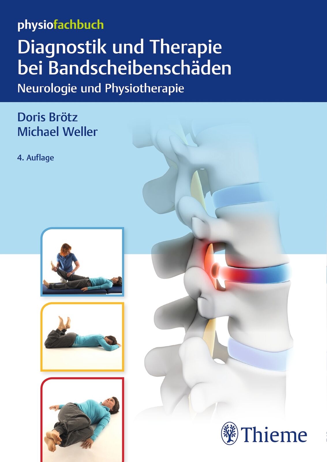 Thumbnail - Doris Brötz; Michael Weller / Diagnostik Und Therapie Bei