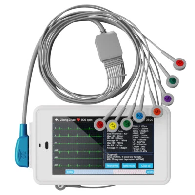 6/12-Kanal EKG-Gerät mit Glasgow-Algorithmus Automatischen Analyse von EKG-Daten