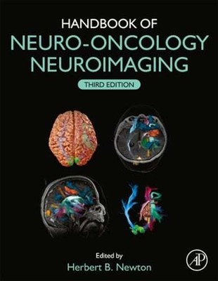 Handbook of Neuro-Oncology Neuroimaging by Herbert B Newton: Used