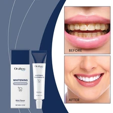 Fluoride-Free Hydroxyapatite Teeth Whitening Toothpaste Teeth Whitening