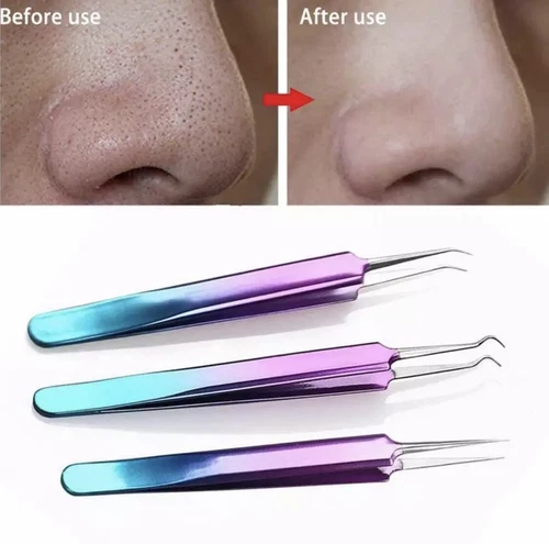 Stainless Steel Blackhead Acne Blemish Pimple Extractor Remover Needles 3 shapes