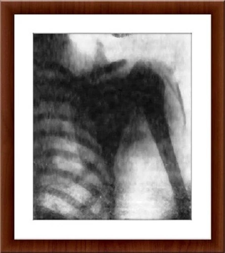 Nikola Tesla Chest X Ray Roentgen Ray Photo Wall Art
