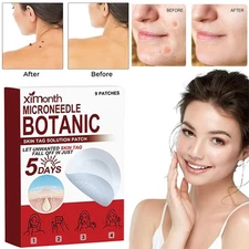 1*Box / 9*pcs MICRONEEDLE BOTANIC Skin Tag & Acne Patch Skin Tag Remover Patches
