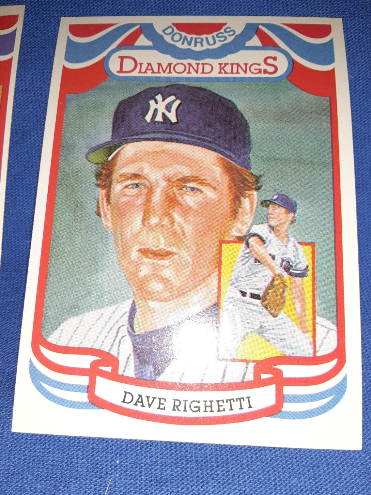 1984 Donruss - Diamond Kings "Perez-Steel" on Back #10 Dave Righetti YANKEES MVP