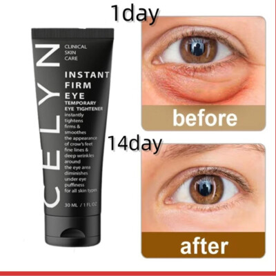 EYE FIRMER LIFT FIRMER BAG REMOVAL WRINKLE CARE EYE CREAM DARK CIRCLE REMOVER