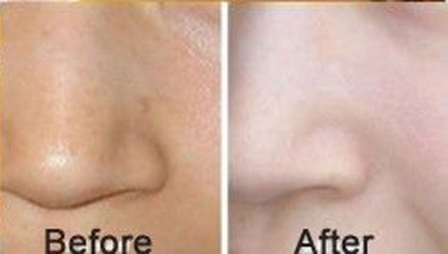 10 PCS Gold Bio-Collagen Facial (Face) Mask Anti-Aging Hydrating Repair Skin - Picture 7 of 7