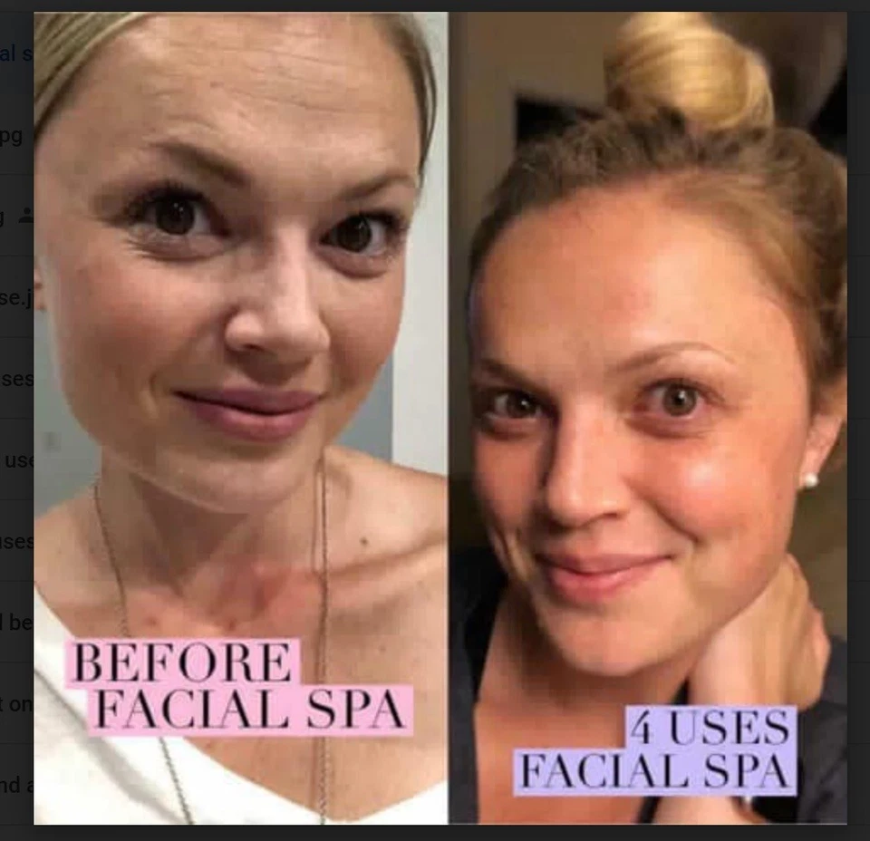 Nuskin ageLOC Galvanic Spa Facial Gels for Anti-Ageing Device - 4 Boxes - Image 3 of 4