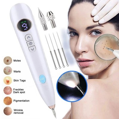 9 Stufen Laser-Plasma Stift zur Entfernung von Muttermalen und dunklen Flecken