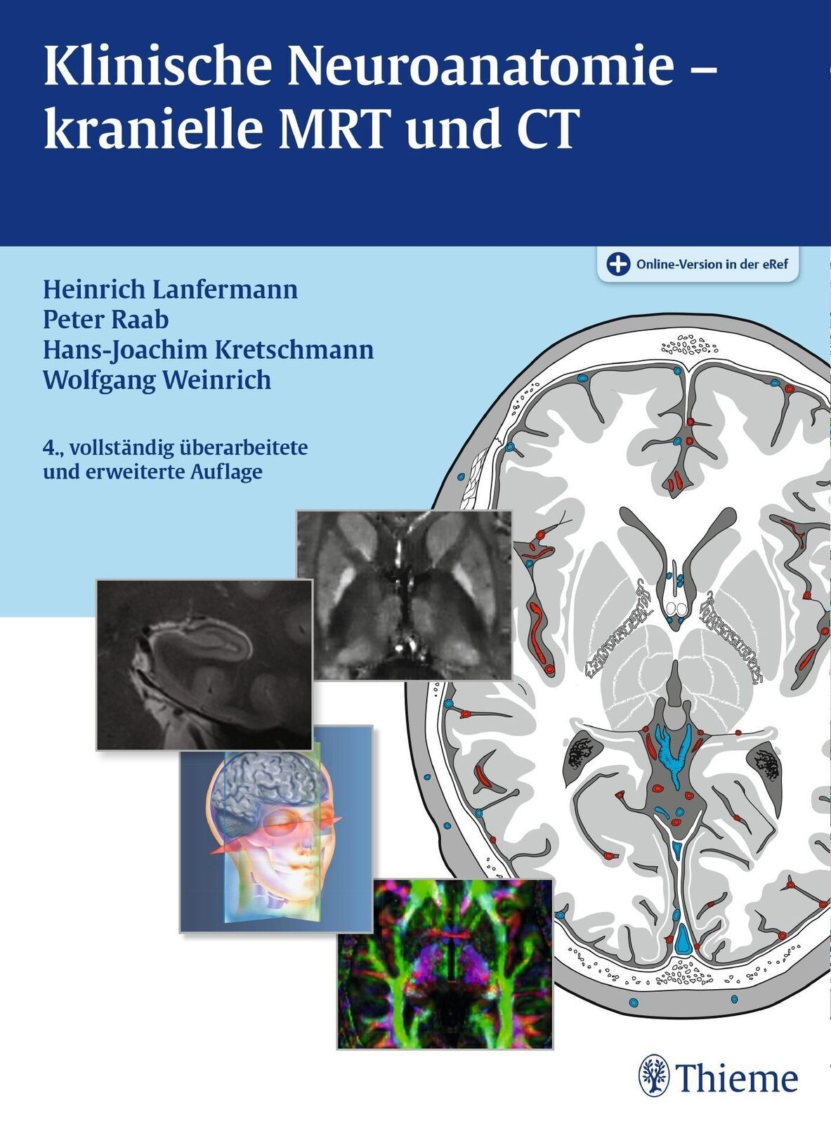 Thumbnail - Klinische Neuroanatomie - Kranielle Mrt Und Ct Heinrich Lanfermann