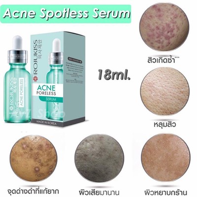 acne poreless serum