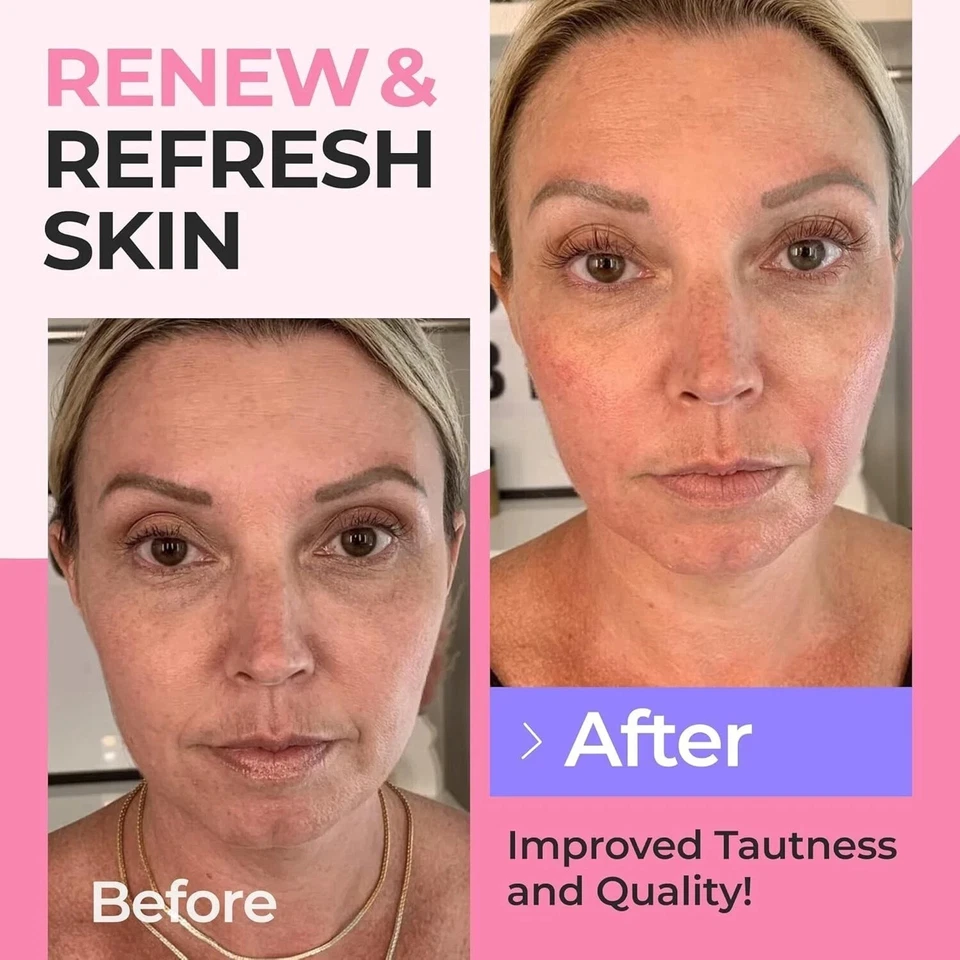 Polvo hidrolizado de péptidos de colágeno para mujeres proteína de colágeno tipos I-III 5 LB Foto 4 de 4